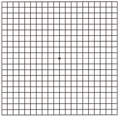 amslergrid.jpg